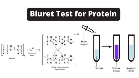 Biuret Test for Protein: Principle, Procedure, Results, .